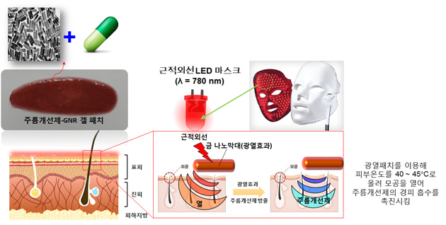 주름개선용 포토닉 필러 시스템 개발 (주름개선제-GNR 겔 패치, 근적외선 LED 마스크(A = 780nm), 표피, 진피, 피하지방, 근적외선을 금 나노막대(광열효과), 모공에 열을 가하면 광열효과와 주름개선제 방출을 하며, 모공, 주름개선제를 사용, 광열패치를 이용해 피부온도를 40 ~ 45℃로 올려 모공을 열어 주름개선제의 경피 흡수를 촉진 시킴 